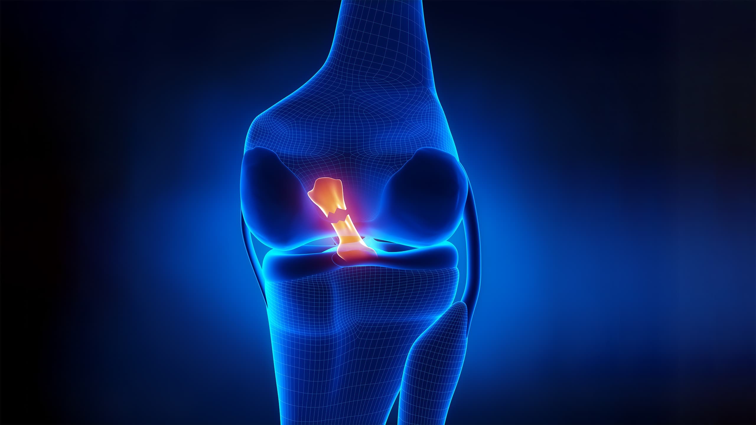 Schéma anatomique du ligament croisé antérieur