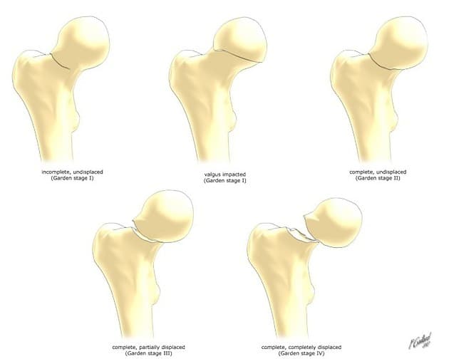 Classification de Garden, représentation complémentaire