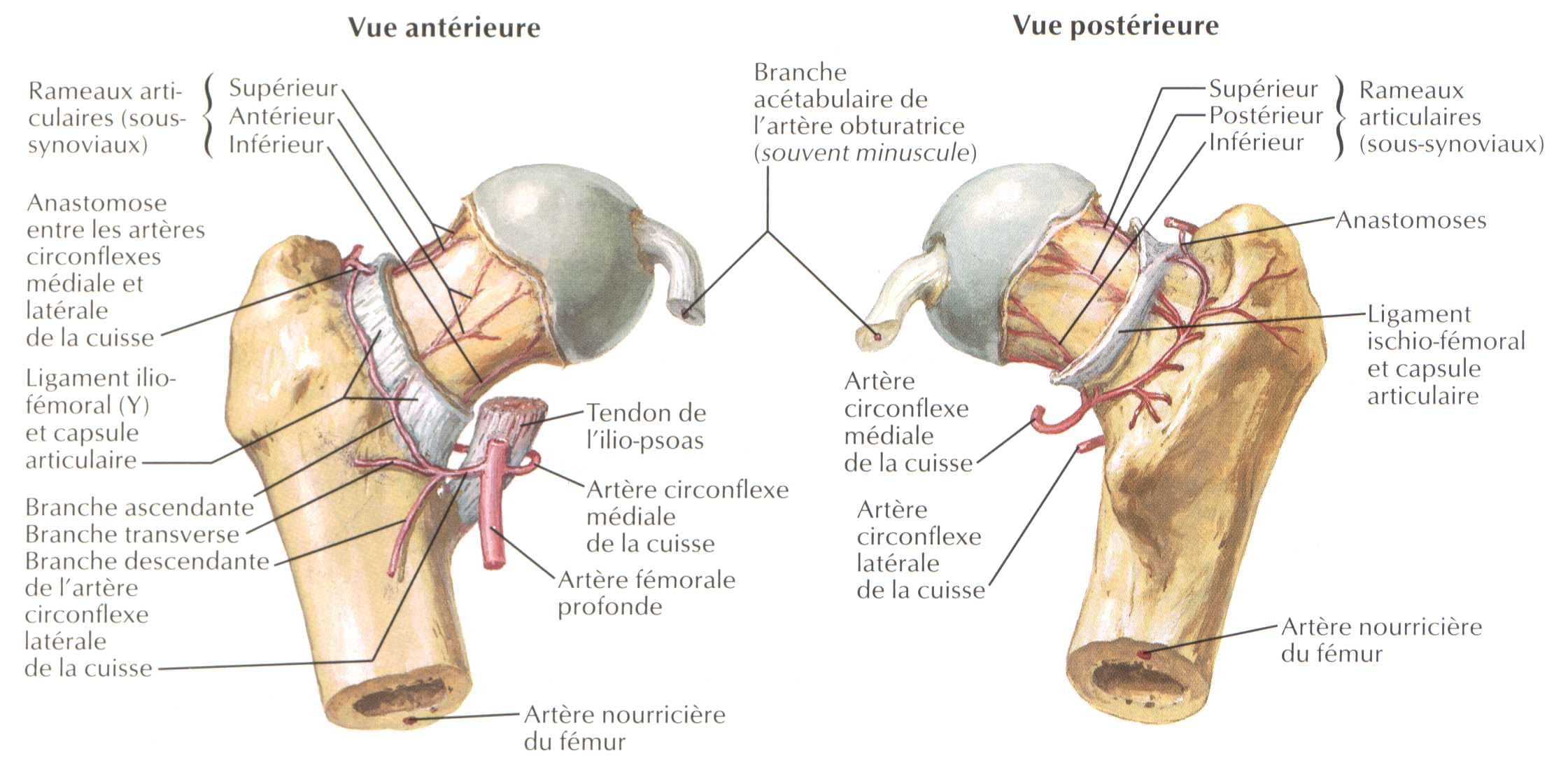 Vue anatomique d'ostéonécrose de la tête fémorale